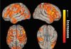 Brain network activity can improve in epilepsy patients after surgery