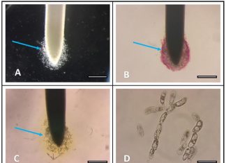 Methods in belowground botany