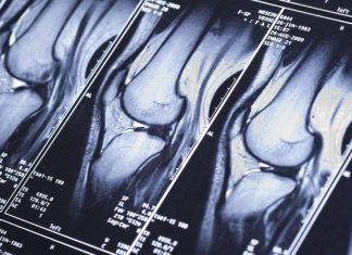 Unity Biotechnology shows results highlighting long road ahead – STAT