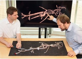 New system for precise navigation through the vascular system