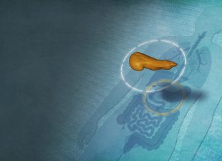 NIH publishes largest genomic study on type 2 diabetes in sub-Saharan African populations
