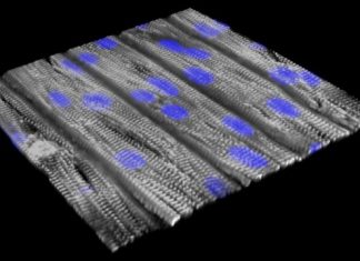 Proposed gene therapy for a heart arrhythmia, based on models made from patient cells