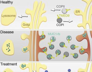 Proteinopathy Cleared Up after Cargo Receptor Made to Give Up Misfolded Protein