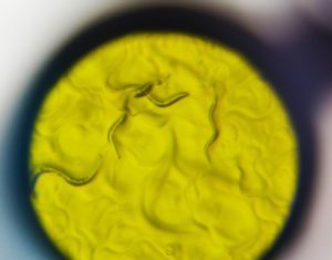 Anti-Opioid Pathway Discovered via Forward Genetics Approach with C. elegans