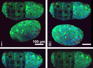 Organ-on-e-chip Biosensor Shrink Wraps Heart Cells