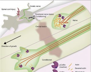 Severed Nerves Could Be Repaired If Actin Filaments Are Severed, Too