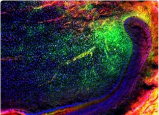 Tooth repair using stem cells may soon be a reality