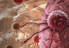 Researchers discover how cancer cells can trigger chronic muscle wasting condition
