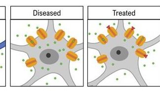 Alzheimer’s Memory Loss Could Be Treated with Calcium Channel Blocker