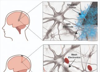 Mesh electronics could make brain stimulation the new therapeutic norm