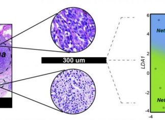 MicroRNA Biomarkers Make Melanoma Diagnosis More Objective