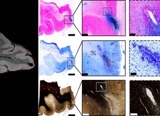 New brain research could change how concussions are treated