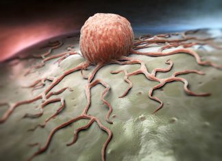 New grants support research on mechanics of tumor cells