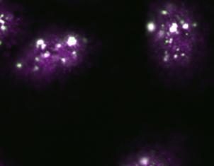 Fine-tuning gene expression during stress recovery
