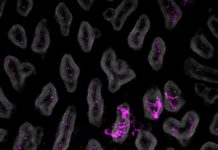 Intestinal Stretch Tells Brain to Switch Off Appetite