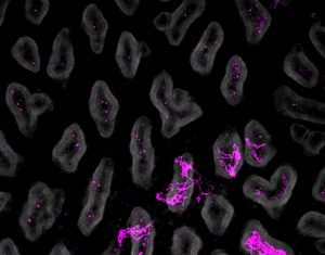 Intestinal Stretch Tells Brain to Switch Off Appetite