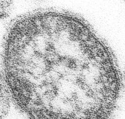Measles Results in Immune Amnesia, Cripples Ability to Fight Future Infections