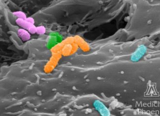 Study shows novel protein plays role in bacterial vaginosis