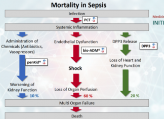 Fighting sepsis mortality – European Biotechnology