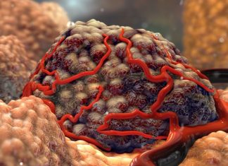French Biotech Raises €19M to Hit Phase I with Cancer… – Labiotech.eu