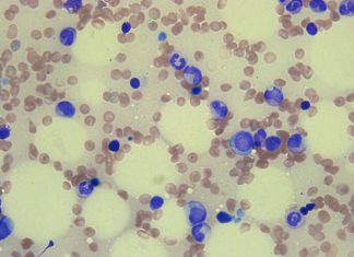 Mutations in donors’ stem cells may cause problems for cancer patients