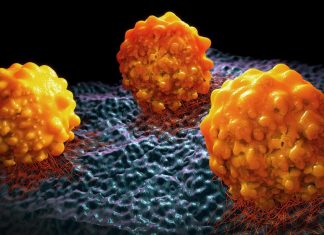 Preventing metastasis by stopping cancer cells from making fat