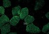 Super-Resolution Microscopy Comes into Focus