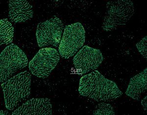 Super-Resolution Microscopy Comes into Focus