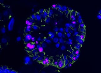 Cutting off kidney cancer at its roots