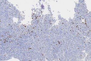 Engineered Probiotic Bacteria Deliver Anticancer Nanobodies to Regress Tumors in Mice