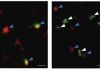 Targeting ILC2 Cells in the Brain May Reduce Age-Related Cognitive Decline and Associated Diseases