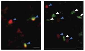 Targeting ILC2 Cells in the Brain May Reduce Age-Related Cognitive Decline and Associated Diseases