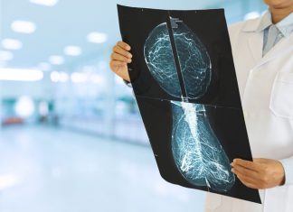 Why Puma Biotechnology Is Soaring Today – Motley Fool