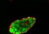 Obesity Linked to Protein Involved in Controlling Fatty Acid Uptake
