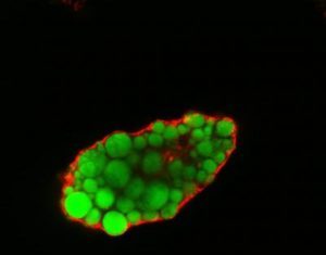 Obesity Linked to Protein Involved in Controlling Fatty Acid Uptake