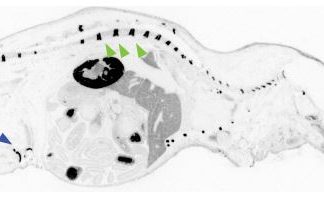 Scorpion Venom Miniprotein Takes the Sting out of Rheumatoid Arthritis Therapy