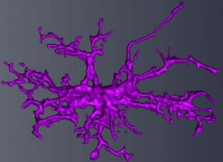 Autism in males linked to defect in brain immune cells, microglia