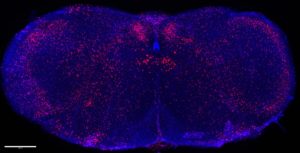 Gut-Brain Circuit That Isn’t Fooled by Artificial Sweeteners Could Explain Our Sugar Cravings
