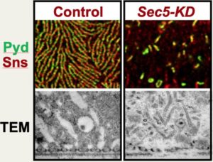 Role of Gene Mutations in Kidney Disease Described in New Study