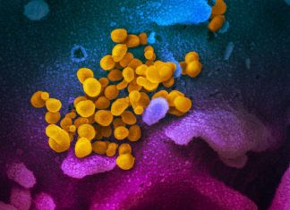 Biogen and Vir Biotechnology Partner to Manufacture SARS-CoV-2 Antibodies for Potential COVID-19 Treatment – HospiMedica