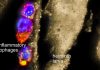 Drug from worms dampens autoimmune response – European Biotechnology