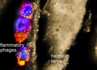 Drug from worms dampens autoimmune response – European Biotechnology
