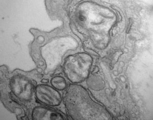 Link Discovered between Blood Vessel Inflammation and Malfunctioning Mitochondria