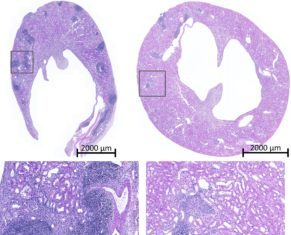 Transplant Rejection May Be Prevented by Blocking Innate Immune Memory