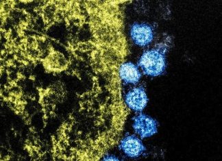A drug to treat harsh complications of coronavirus infection is registered in Russia