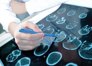 AFFiRiS AG announces results of phase 1 trial with PD01A in Parkinson’s