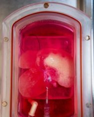 Human Mini Livers Function in Rat Recipients