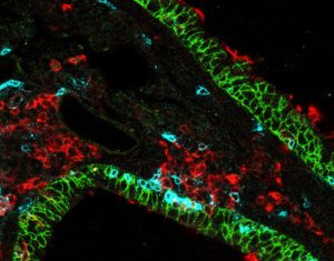 New Insights into Respiratory Virus Immunity Could Aid Vaccine Design