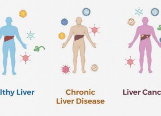 NIH Blood Test Developed for Liver Cancer Screening