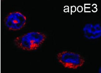 Researchers Discover Why ApoE4 Increases the Risk of Alzheimer’s Disease